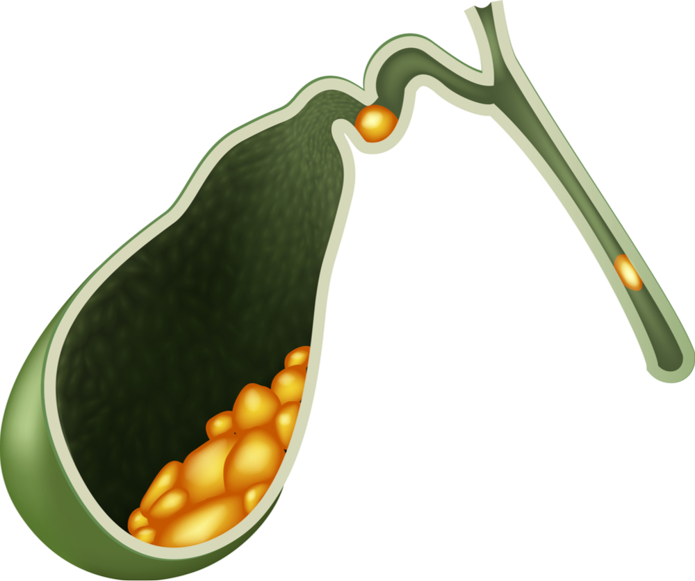 Gallbladder Surgery